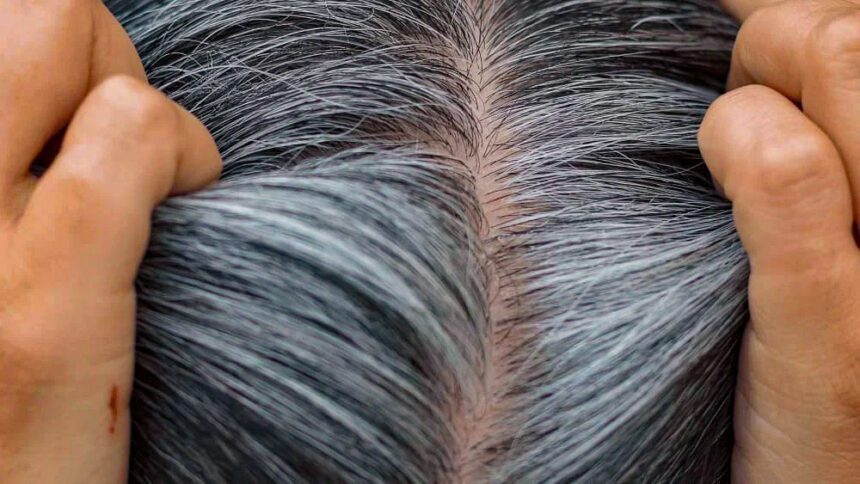 The premature graying problem has a solution